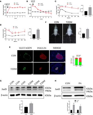 JunD Regulates Pancreatic β-Cells Function by Altering Lipid Accumulation